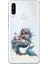 General Mobile Gm 20 Pro Uyumlu Deniz Kızı Desenli Silikon Kılıf 1
