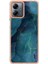 Motorola Moto G14 Tampon Tpu Darbeye Silikon Mermer ile Uyumlu (Yurt Dışından) 3