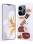 Tecno Camon 20 Kılıf Figürlü ve Ince Simli Şık Mellila Premium Kapak 1