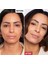cc Dull Correct - Aydınlatıcı Bakım Kremi 15 ml 3