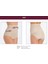 Iç Giyim Miss Fit Doğum Sonrası Korse Mideli Body Slip Korse Külot 3