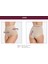 Iç Giyim Miss Fit Silikonlu Kaymaz Yüksek Bel Slip Korse 3