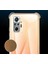 - Redmi Note 10S - Kılıf Kamera Korumalı Nitro Anti Shock Silikon - Şeffaf 5