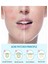 Akne Pimple Temizleme Bandı - Acne Pimple Patch 2