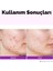 Hyalusteen Repair Emulsion Cilt Nemlendirici Onarıcı Ve Yenileyici Emülsiyon Krem Kore 120ml 4