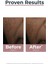 Anti-Pigment Spot Corrector 5ml 3