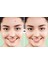 48 Adet Bant Hidrokolloid, Pimple Patch Hydrocollaid 1