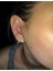 Cerrahi Çelik Minik Zirkon Taşlı Rosegold Labret Piercing -Bar Kalınlığı 1,2mm-Top Çapı 3mm-1 Adet 5