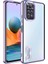 Redmi Note 11 Global Kılıf Detaylı Esnek Elis Lazer Silikon Kapak 1