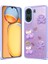 Redmi 13C Kılıf Sim Süslemeli ve Figürlü Parlak Dipy Premium Silikon Kapak 1