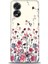 Oppo A38 Ile Uyumlu Hd Baskılı Silikon (Ortasertlikte) Kılıf - 178 1