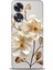 Oppo A60 Ile Uyumlu Hd Baskılı Silikon (Ortasertlikte) Kılıf - 1049 1