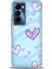 Tecno Camon 18 Premier (CH9N) Premier Ile Uyumlu Hd Baskılı Silikon (Ortasertlikte) Kılıf - 811 1