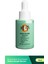 Yağlanma Akne ve Siyah Nokta Karşıtı Serum 30 ml 1