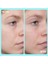 10% Vitamin C Brightening Serum - Aydınlatıcı Serum 50 ml 3