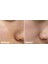 Medıcube Zero Pore Toner (Gözenek Karşıtı Tonik)(Globalcare) 3