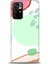 Xiaomi Redmi Note 11 Pro Plus Kılıf Hd Baskılı Kılıf - Benekli 1