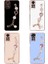 Xiaomi Redmi Note 11 Global Kılıf El Tutamaçlı Kamera Korumalı Taka Silikon Kapak-Mor 2