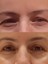 BIR'SENSE Restoratıve Ultra Mask 3
