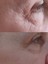 BIR'SENSE Restoratıve Ultra Mask 4