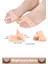 Kemik Büyümesi Karşıtı Şekil Bozukluğu Önleyici Ayak 5 Parmak Ayıran Silikon Bunyon Ayırıcı 4'lü Set 2