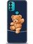 General Mobile Gm 21 Plus Kılıf Hd Baskılı - Ipteki Teddy 1