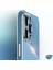Xiaomi Redmi Note 10 Pro Için Kılıf Olive Plated Siyah [Xiaomi Redmi Note 10 Pro ile Uyumlu Kılıf - Siyah] 3