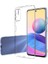 Xiaomi Redmi Note 10 5g Uyumlu Kılıf Zebana Şeffaf Soft Silikon Kılıf Şeffaf 1