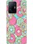 Xiaomi Mi 11T - 11T Pro Kılıf Desenli Design Silikon Donut 1