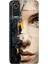 General Mobile Gm 22 Pro Kılıf Hd Desenli Esnek Silikon Beauty 1