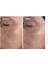 Glycolic Acid 7 % 4