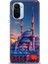 Xiaomi Mi 11I Kılıf Hd Baskılı Kılıf + Seramik Tam Kaplayan Ekran Koruyucu 227 1