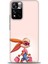 Xiaomi Redmi Note 11 Pro Plus Hd Baskılı Kılıf + Seramik Tam Kaplayan Ekran Koruyucu 404 1