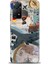 Xiaomi Redmi Note 11 Pro 4g Hd Baskılı Kılıf + Seramik Tam Kaplayan Ekran Koruyucu 261 1