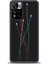 Xiaomi Redmi Note 11 Pro Plus Hd Baskılı Kılıf + Seramik Tam Kaplayan Ekran Koruyucu 385 1