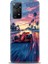 Xiaomi Redmi Note 11 Pro 4g Hd Baskılı Kılıf + Seramik Tam Kaplayan Ekran Koruyucu 102 1