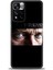 Xiaomi Redmi Note 11 Pro Plus Hd Baskılı Kılıf + Seramik Tam Kaplayan Ekran Koruyucu 28 1