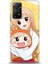 Xiaomi Redmi Note 11 Pro 4g Hd Baskılı Kılıf + Seramik Tam Kaplayan Ekran Koruyucu 498 1