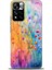 Xiaomi Redmi Note 11 Pro Plus Hd Baskılı Kılıf + Seramik Tam Kaplayan Ekran Koruyucu 413 1