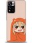 Xiaomi Redmi Note 11 Pro Plus Hd Baskılı Kılıf + Seramik Tam Kaplayan Ekran Koruyucu 499 1