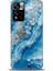 Xiaomi Redmi Note 11 Pro Plus Hd Baskılı Kılıf + Seramik Tam Kaplayan Ekran Koruyucu 317 1