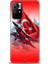 Xiaomi Redmi Note 11 Hd Baskılı Kılıf + Seramik Tam Kaplayan Ekran Koruyucu 38 1