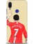 Xiaomi Redmi Note 7 Hd Baskılı Kılıf + Seramik Tam Kaplayan Ekran Koruyucu 3 1