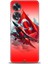 Oppo A60 Kılıf Hd Baskılı Kılıf + Seramik Tam Kaplayan Ekran Koruyucu 38 1