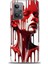 Realme Gt2 Kılıf Hd Baskılı Kılıf + Seramik Tam Kaplayan Ekran Koruyucu 150 1