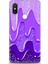 Xiaomi Mi 8 Se Kılıf Hd Baskılı Kılıf + Seramik Tam Kaplayan Ekran Koruyucu 421 1