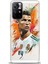 Xiaomi Redmi Note 11S Hd Baskılı Kılıf + Seramik Tam Kaplayan Ekran Koruyucu 7 1