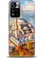 Xiaomi Redmi Note 11 Pro Plus Hd Baskılı Kılıf + Seramik Tam Kaplayan Ekran Koruyucu 226 1