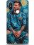 Xiaomi Mi 8 Se Kılıf Hd Baskılı Kılıf + Seramik Tam Kaplayan Ekran Koruyucu 12 1