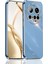 Xiaomi Mi 15 Ultra Kılıf Kamera Korumalı Parlak Gold Altın Işlemeli Kenarlı Yumuşak Silikon Kapak 1